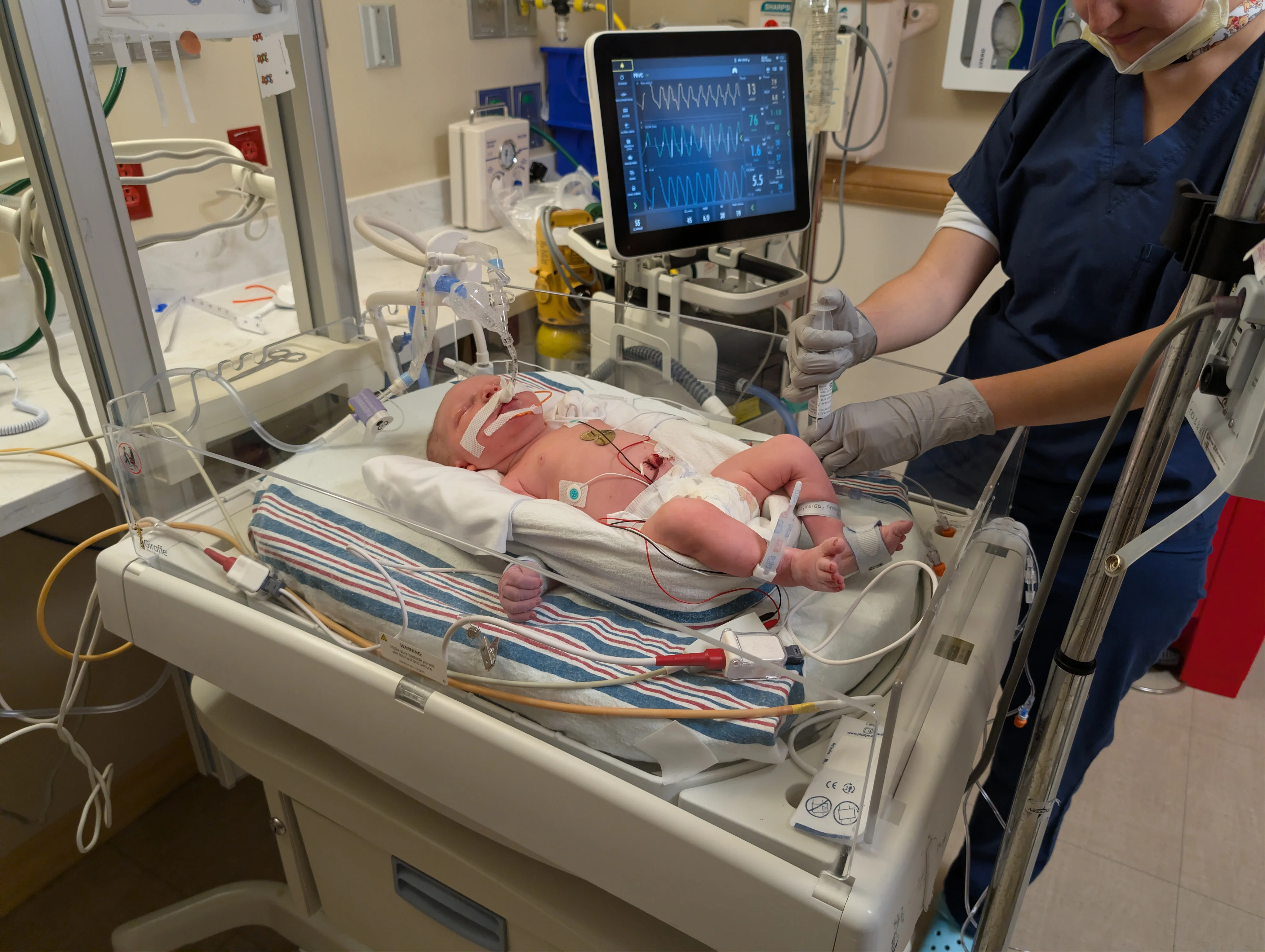 Newborn Nolan in a NICU bassinet with breathing tubes and monitor leads, a nurse tending to him beside a vitals monitor.